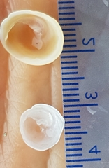 Calyptraea chinensis