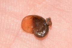 Parmavitrina megastoma