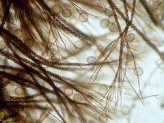 Prototrichia schroeteri