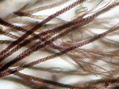 Prototrichia schroeteri