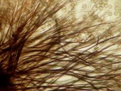 Prototrichia schroeteri