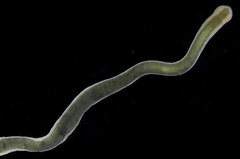 Emplectonema