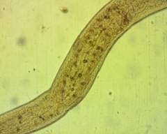 Stenostomum