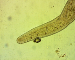 Stenostomum
