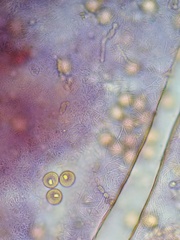 Trichia botrytis