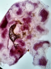 Trichia botrytis