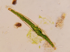 Closterium striolatum