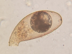 Cyphoderia ampulla