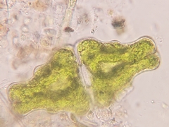 Euastrum humerosum