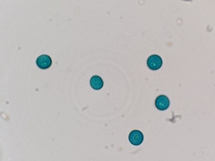 Trichia botrytis