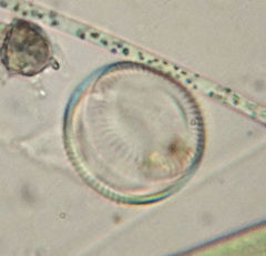 Cyclotella