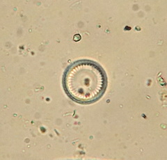 Cyclotella