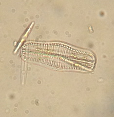 Epithemia gibba
