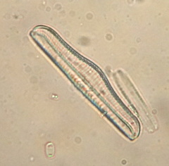 Epithemia gibba