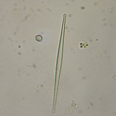 Fragilaria tenera