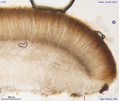 Adelphella babingtonii