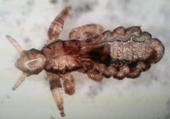 Pediculus humanus capitis