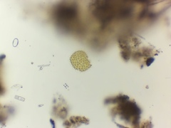 Pseudopediastrum boryanum longicorne