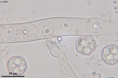 Pulvinula convexella