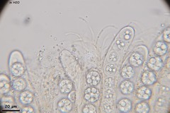 Pulvinula convexella