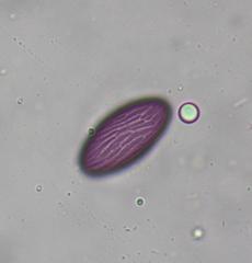 Ascobolus furfuraceus