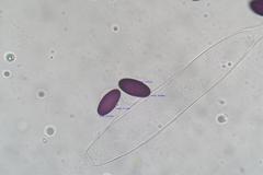 Ascobolus furfuraceus