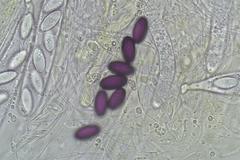 Ascobolus furfuraceus