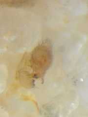 Anaxibia pictithorax