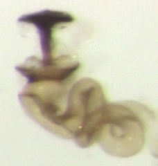 Acrotrichis insularis