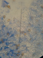 Inocybe appendiculata