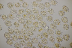 Pucciniastrum epilobii