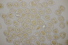 Pucciniastrum epilobii