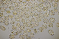 Pucciniastrum epilobii