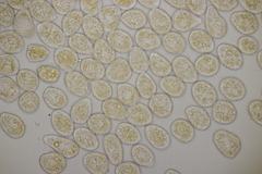 Pucciniastrum epilobii