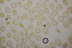 Pucciniastrum epilobii