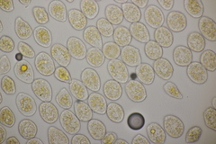 Pucciniastrum epilobii