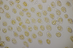 Pucciniastrum epilobii