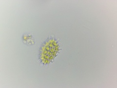 Pseudopediastrum boryanum longicorne