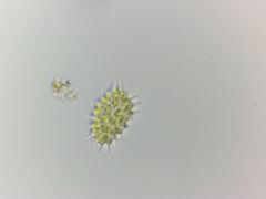 Pseudopediastrum boryanum longicorne