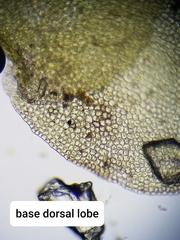 Scapania irrigua