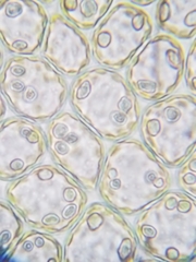 Scapania irrigua