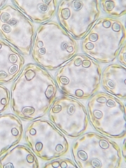 Scapania irrigua