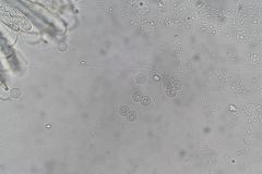 Pulvinula archeri