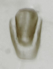 Octotemnus dilutipes