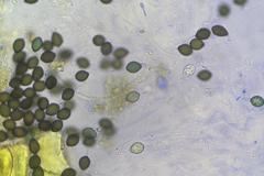 Podospora setosa