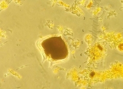 Protoperidinium