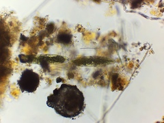 Tetmemorus brebissonii