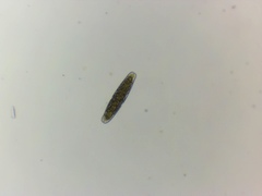 Tetmemorus brebissonii