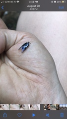Hololepta