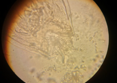 Lecane quadridentata